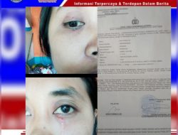 “Diduga Cemburu Buta LS Tega Menganiaya Seorang Ibu Rumah Tangga Dengan Mencakar Serta Menendang Hingga Lebam ?!”