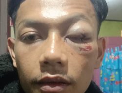 “Tangkap & Penjarakan, Pelaku Penganiayaan Brutal Terhadap Robi Gunawan ?!”