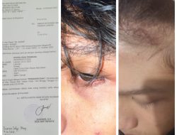 Polres Halmahera Selatan Didesak Segera Tangkap Akbar Terkait Dugaan Penganiayaan Terhadap Fandu