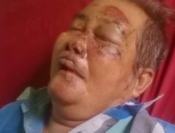 Hamdan Jauhari, Perantau 70 Tahun Asal Bandung Terlantar, Kini Terbaring Sendiri di RSUD Tanpa Keluarga